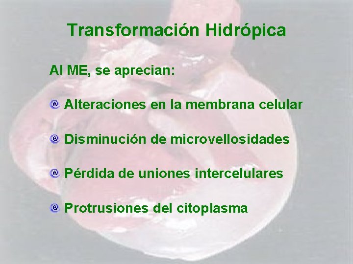 Transformación Hidrópica Al ME, se aprecian: Alteraciones en la membrana celular Disminución de microvellosidades