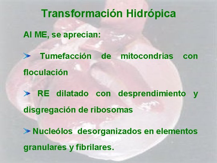 Transformación Hidrópica Al ME, se aprecian: Tumefacción de mitocondrias con floculación RE dilatado con