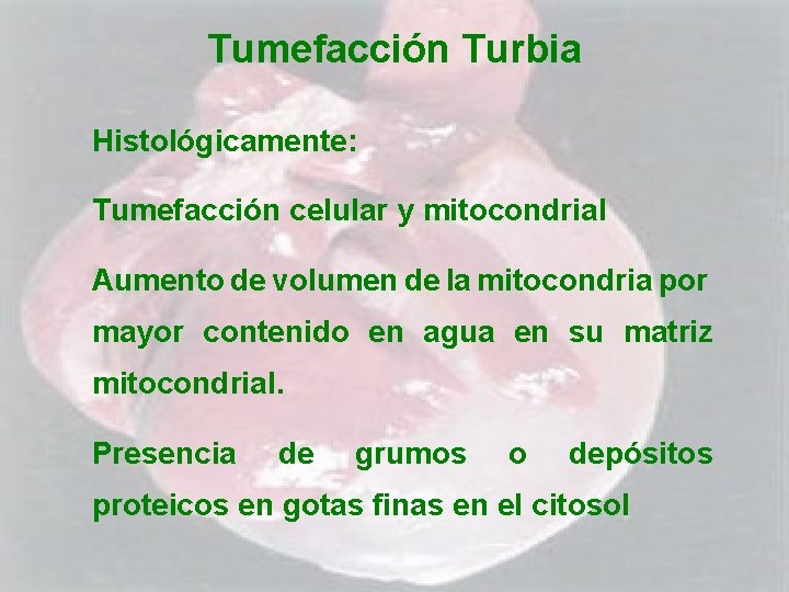 Tumefacción Turbia Histológicamente: Tumefacción celular y mitocondrial Aumento de volumen de la mitocondria por