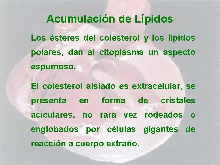 Acumulación de Lípidos Los ésteres del colesterol y los lípidos polares, dan al citoplasma