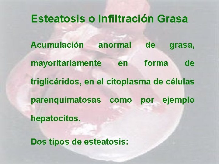 Esteatosis o Infiltración Grasa Acumulación anormal mayoritariamente en de forma grasa, de triglicéridos, en