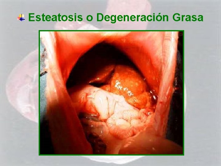 Esteatosis o Degeneración Grasa 