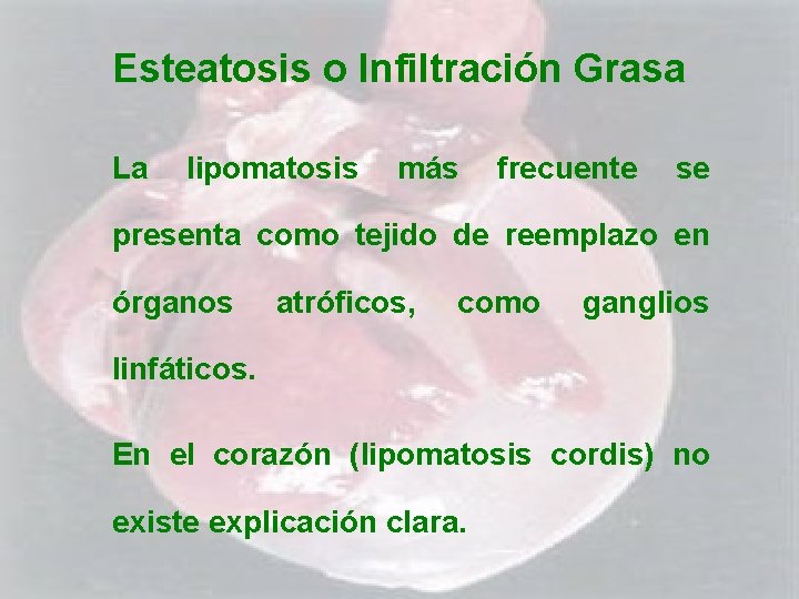 Esteatosis o Infiltración Grasa La lipomatosis más frecuente se presenta como tejido de reemplazo