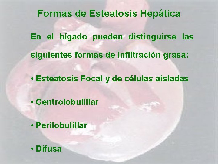 Formas de Esteatosis Hepática En el hígado pueden distinguirse las siguientes formas de infiltración