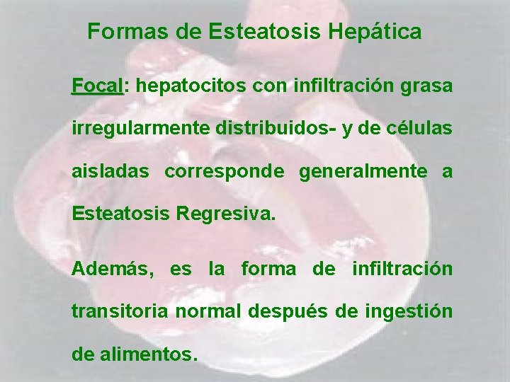 Formas de Esteatosis Hepática Focal: Focal hepatocitos con infiltración grasa irregularmente distribuidos- y de