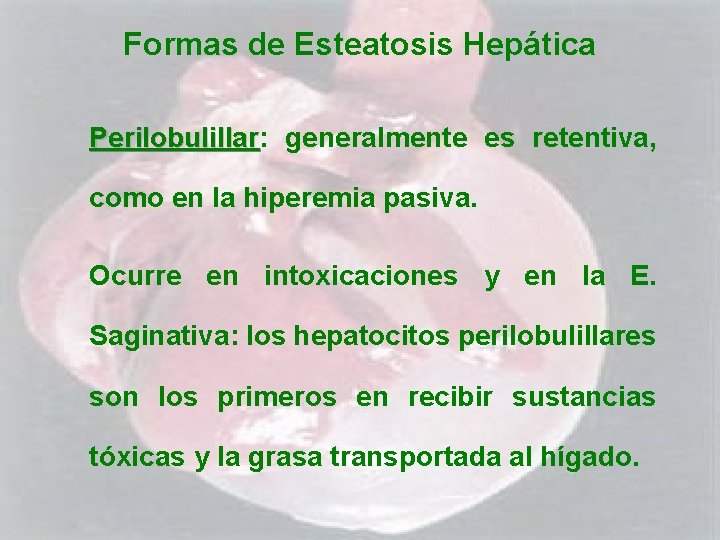 Formas de Esteatosis Hepática Perilobulillar: Perilobulillar generalmente es retentiva, como en la hiperemia pasiva.