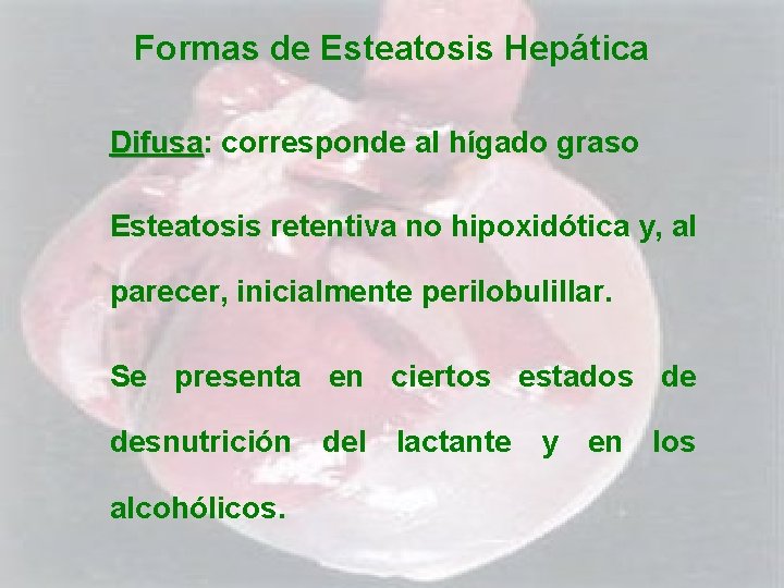 Formas de Esteatosis Hepática Difusa: Difusa corresponde al hígado graso Esteatosis retentiva no hipoxidótica