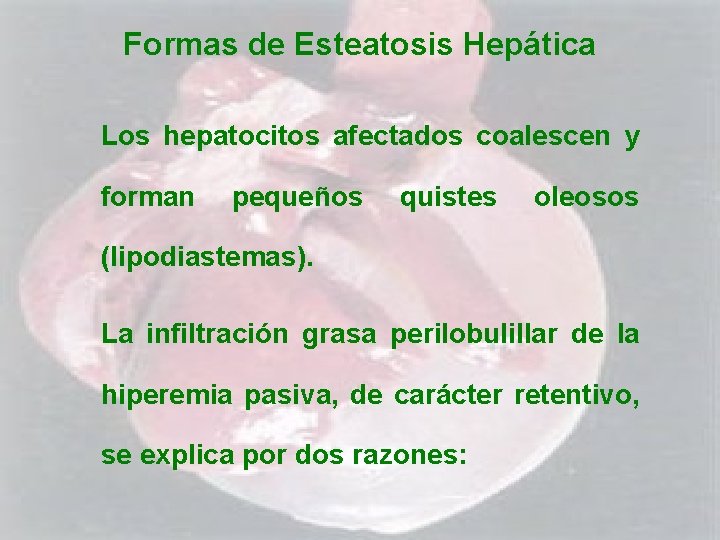 Formas de Esteatosis Hepática Los hepatocitos afectados coalescen y forman pequeños quistes oleosos (lipodiastemas).