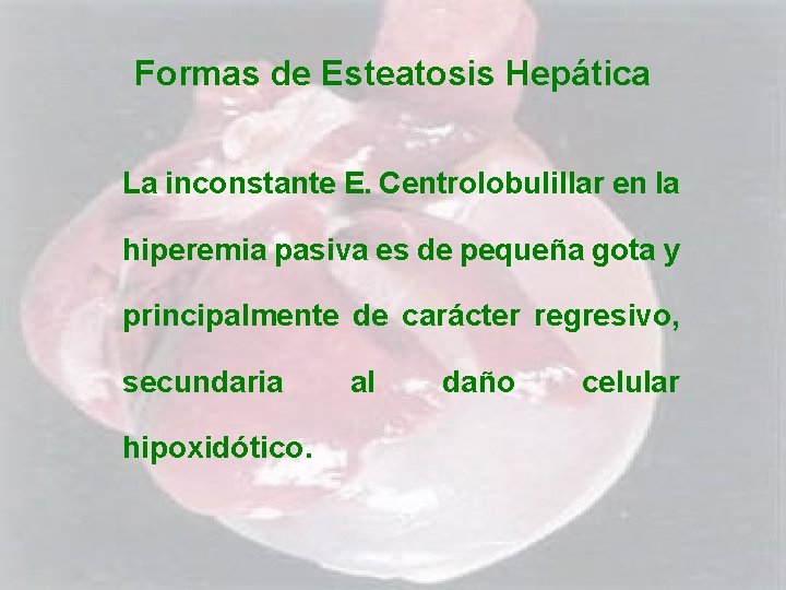 Formas de Esteatosis Hepática La inconstante E. Centrolobulillar en la hiperemia pasiva es de