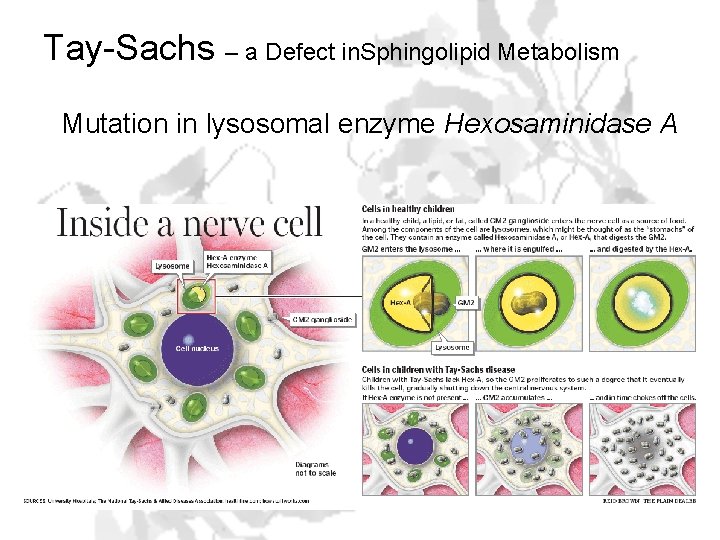 Tay-Sachs – a Defect in. Sphingolipid Metabolism Mutation in lysosomal enzyme Hexosaminidase A 