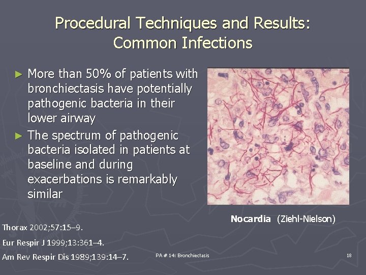 Procedural Techniques and Results: Common Infections More than 50% of patients with bronchiectasis have