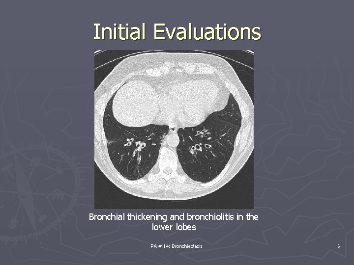 Initial Evaluations Bronchial thickening and bronchiolitis in the lower lobes PA # 14: Bronchiectasis