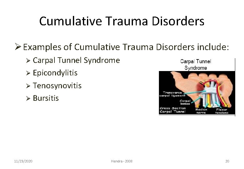 Cumulative Trauma Disorders Ø Examples of Cumulative Trauma Disorders include: Ø Carpal Tunnel Syndrome