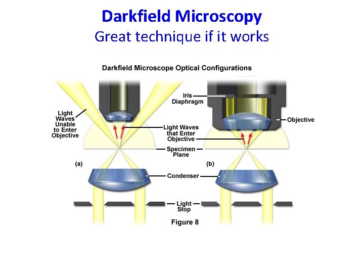 Darkfield Microscopy Great technique if it works 
