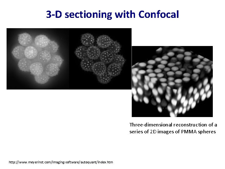 3 -D sectioning with Confocal Three-dimensional reconstruction of a series of 2 D images