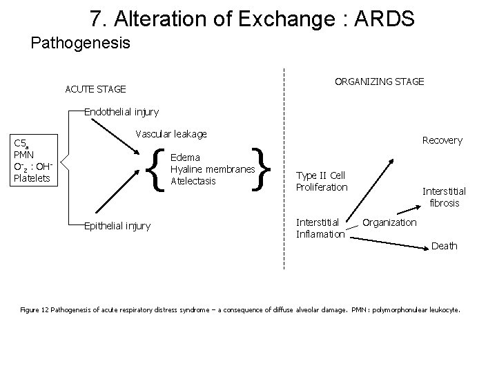 7. Alteration of Exchange : ARDS Pathogenesis ORGANIZING STAGE ACUTE STAGE Endothelial injury C