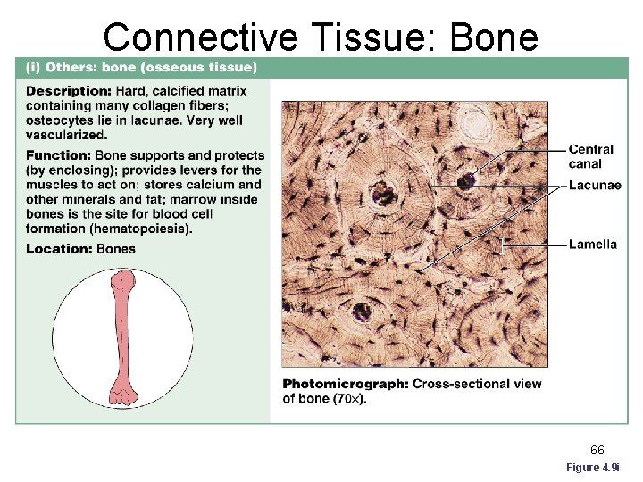 Connective Tissue: Bone (Osseous Tissue) 66 Figure 4. 9 i 