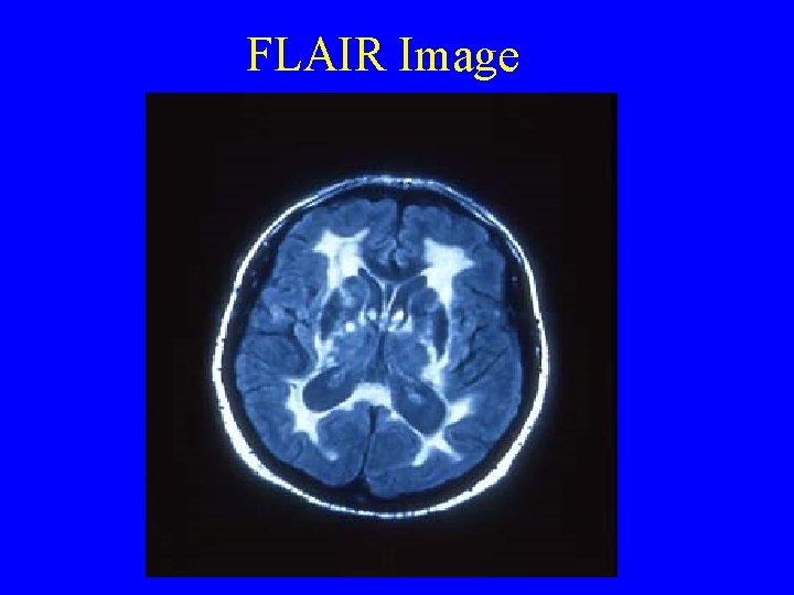 FLAIR Image 