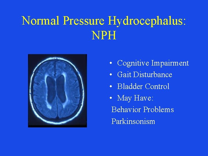 Normal Pressure Hydrocephalus: NPH • Cognitive Impairment • Gait Disturbance • Bladder Control •