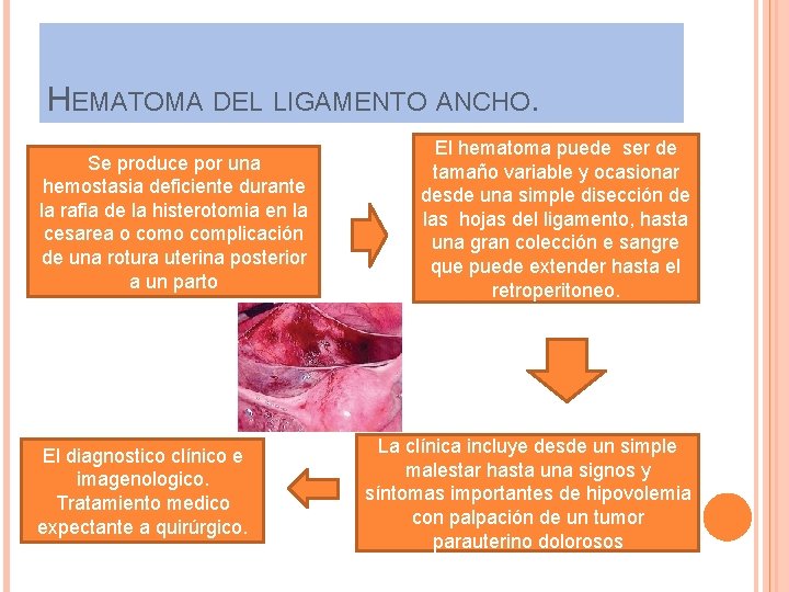 HEMATOMA DEL LIGAMENTO ANCHO. Se produce por una hemostasia deficiente durante la rafia de