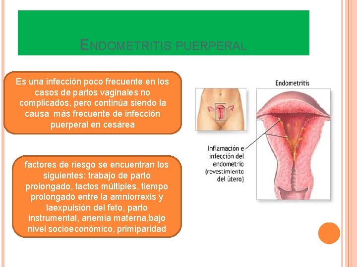 ENDOMETRITIS PUERPERAL Es una infección poco frecuente en los casos de partos vaginales no