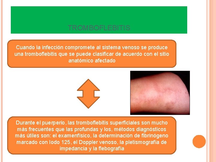 TROMBOFLEBITIS Cuando la infección compromete al sistema venoso se produce una tromboflebitis que se