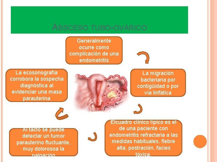 ABSCESO TUBO-OVÁRICO Generalmente ocurre como complicación de una endometritis La ecosonografía corrobora la sospecha