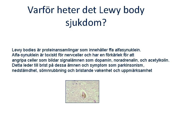 Varför heter det Lewy body sjukdom? Lewy bodies är proteinansamlingar som innehåller ffa alfasynuklein.