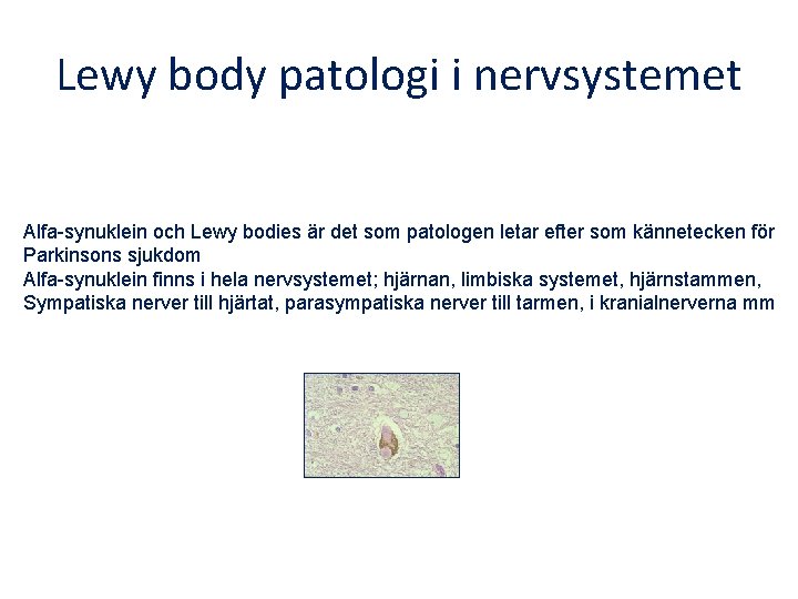 Lewy body patologi i nervsystemet Alfa-synuklein och Lewy bodies är det som patologen letar