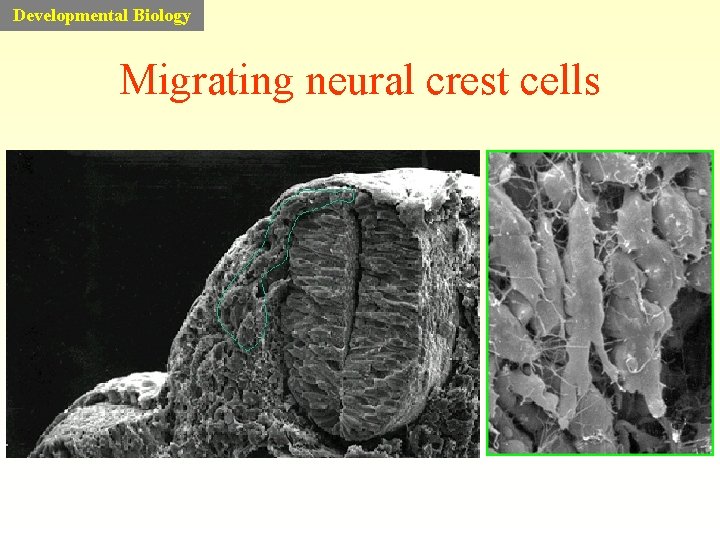 Developmental Biology Migrating neural crest cells 