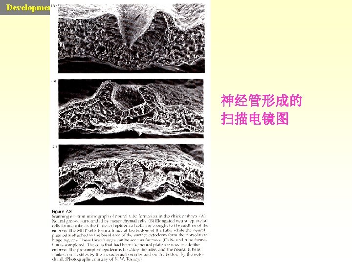 Developmental Biology 神经管形成的 扫描电镜图 