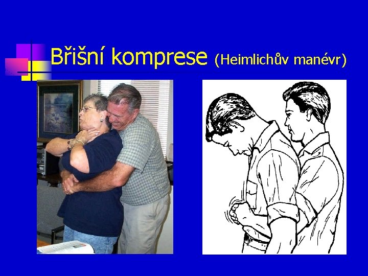 Břišní komprese (Heimlichův manévr) 