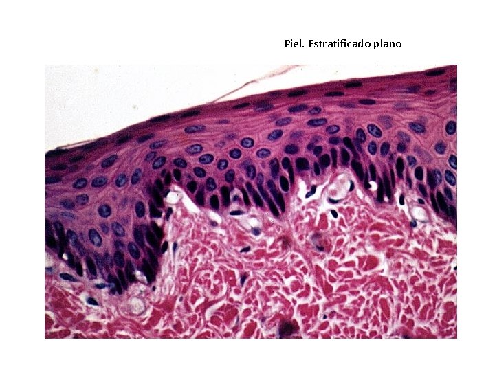 Piel. Estratificado plano 