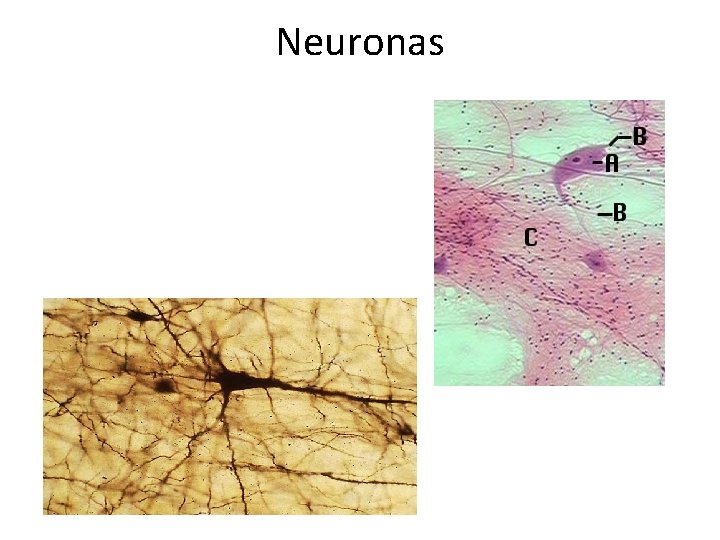 Neuronas 