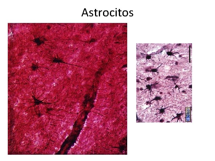 Astrocitos 