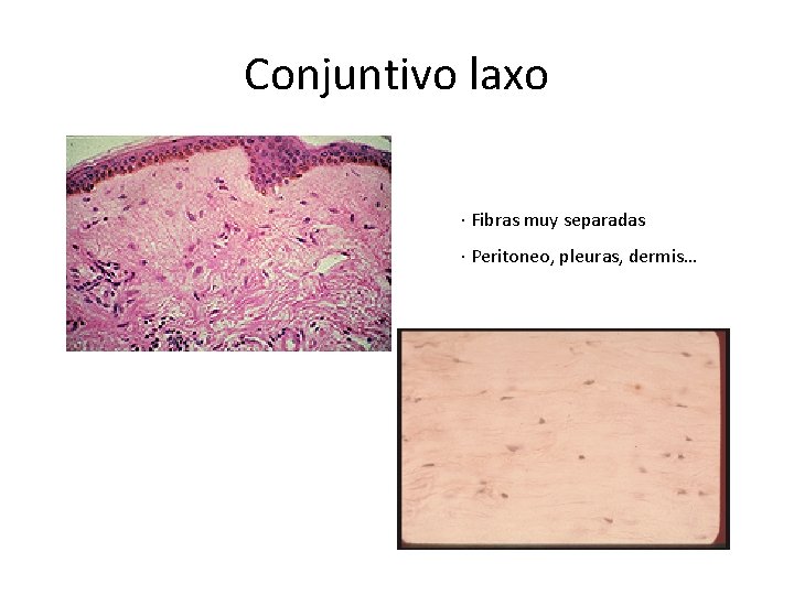 Conjuntivo laxo · Fibras muy separadas · Peritoneo, pleuras, dermis… 