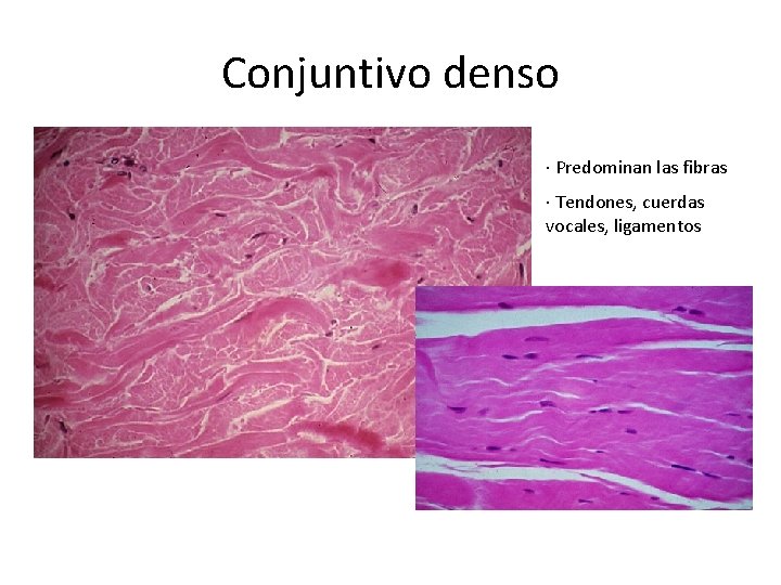 Conjuntivo denso · Predominan las fibras · Tendones, cuerdas vocales, ligamentos 