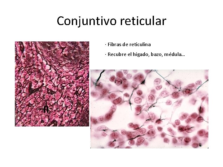 Conjuntivo reticular · Fibras de reticulina · Recubre el hígado, bazo, médula… 