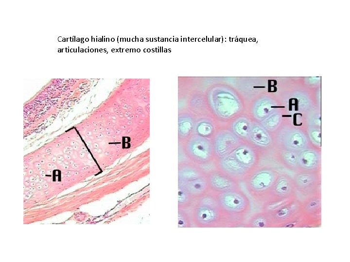 Cartílago hialino (mucha sustancia intercelular): tráquea, articulaciones, extremo costillas 