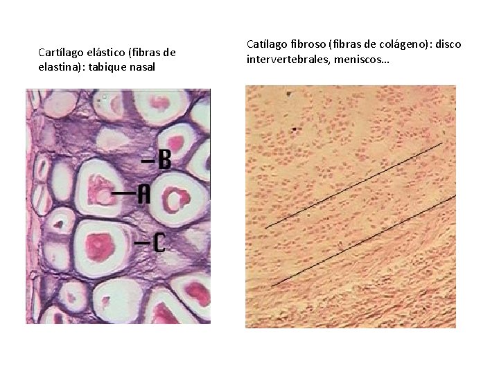 Cartílago elástico (fibras de elastina): tabique nasal Catílago fibroso (fibras de colágeno): disco intervertebrales,