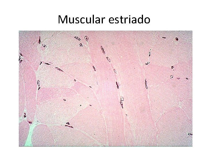 Muscular estriado 