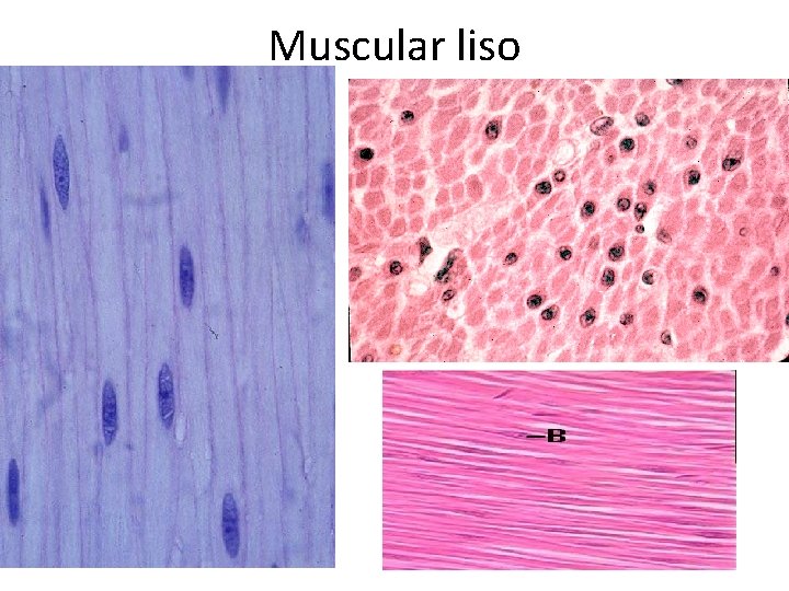 Muscular liso 