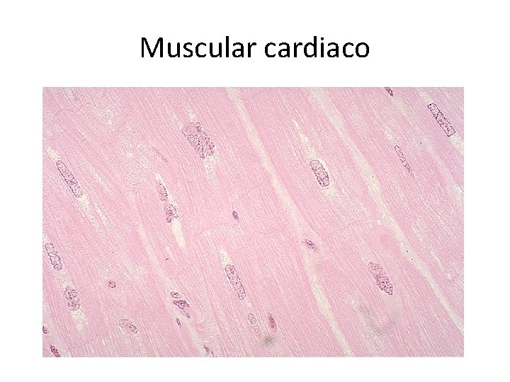 Muscular cardiaco 