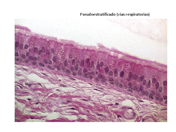 Pseudoestratificado (vías respiratorias) 