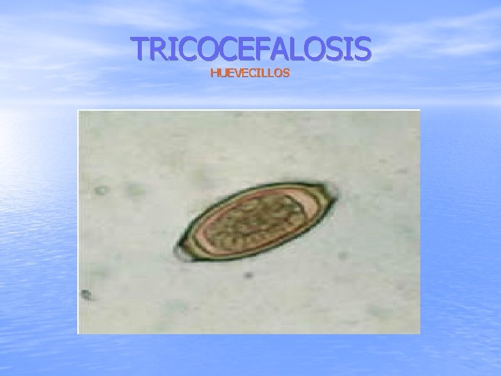 TRICOCEFALOSIS HUEVECILLOS 