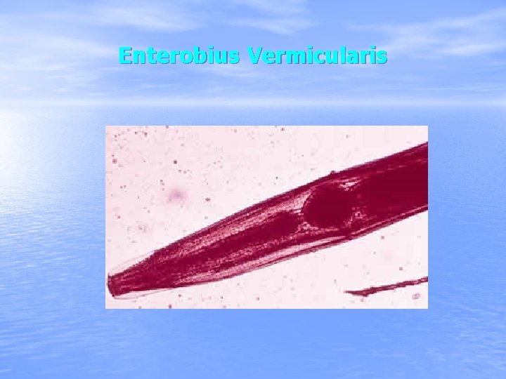 Enterobius Vermicularis 