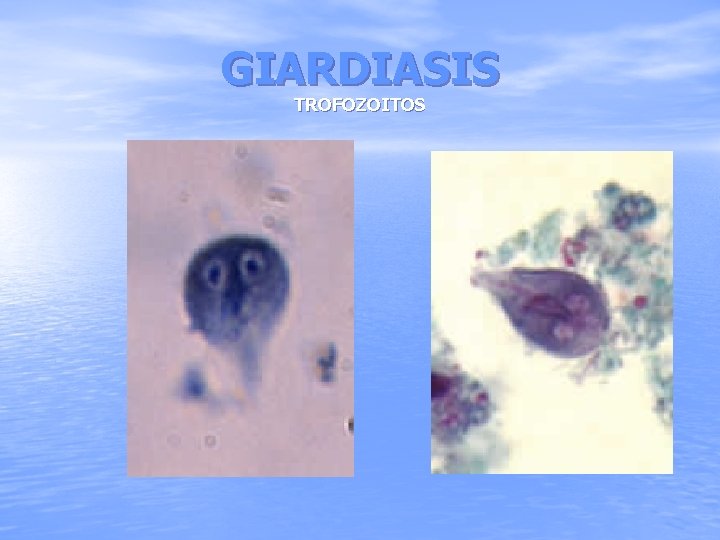 GIARDIASIS TROFOZOITOS 