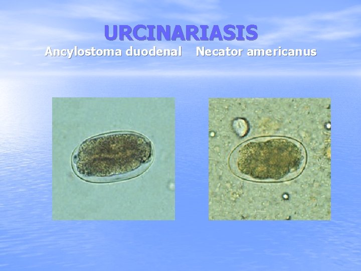 URCINARIASIS Ancylostoma duodenal Necator americanus 