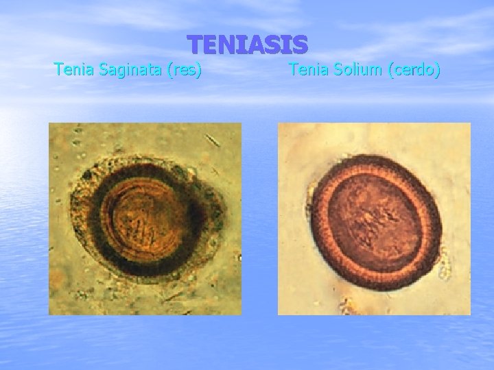 TENIASIS Tenia Saginata (res) Tenia Solium (cerdo) 