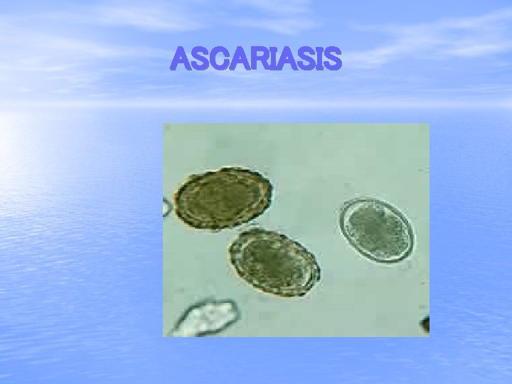 ASCARIASIS 